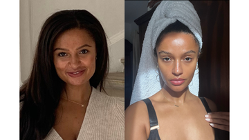 Moon Face and Hormonal Imbalance: What Your Puffiness Is Really Telling You